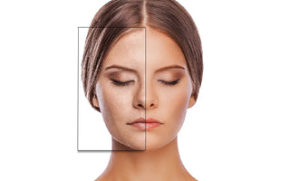 Dile adiós a los poros dilatados y las manchas con la ayuda del retinol