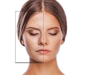 Dile adiós a los poros dilatados y las manchas con la ayuda del retinol