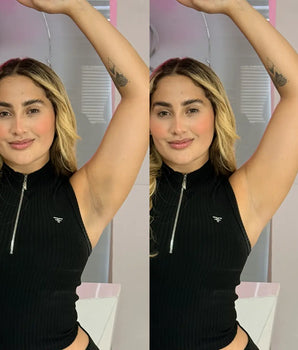 Desodorante Dermatológico y Dermo-Aclarante CB