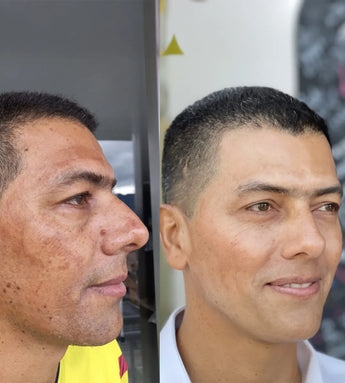 Loción aclarante By Camila Barrientos